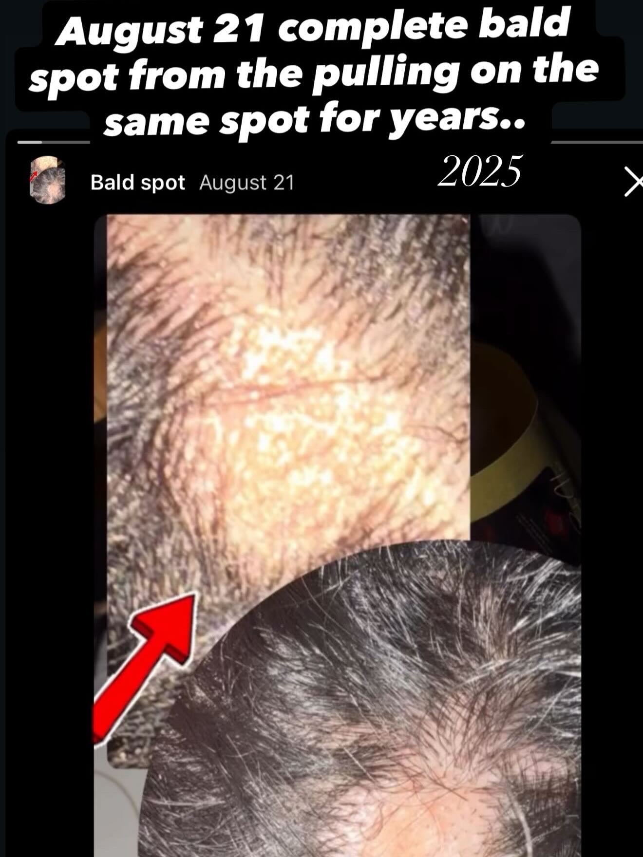 Double Your Hair Growth Oils 4oz (Tropic Botanical Scented)