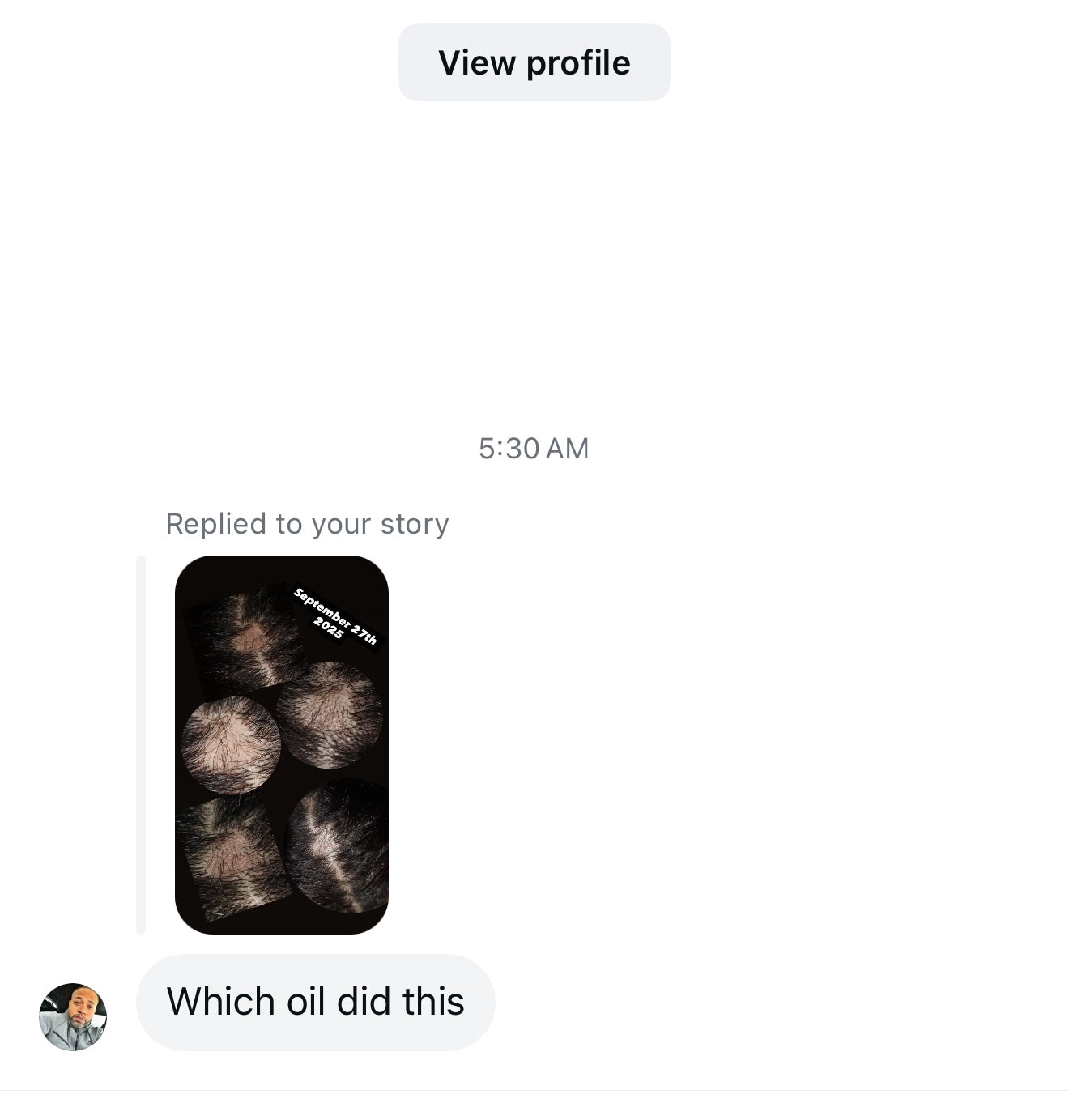 Double Your Hair Growth Oils 4oz (Tropic Botanical Scented)