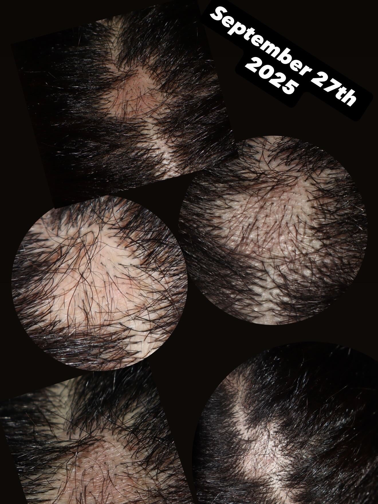 Extra Strength Ayurvedic Hair Growth Oil 4 oz (Tropic Botanical Scented)