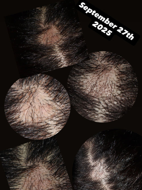 Double Your Hair Growth Oils 4oz (Tropic Botanical Scented)