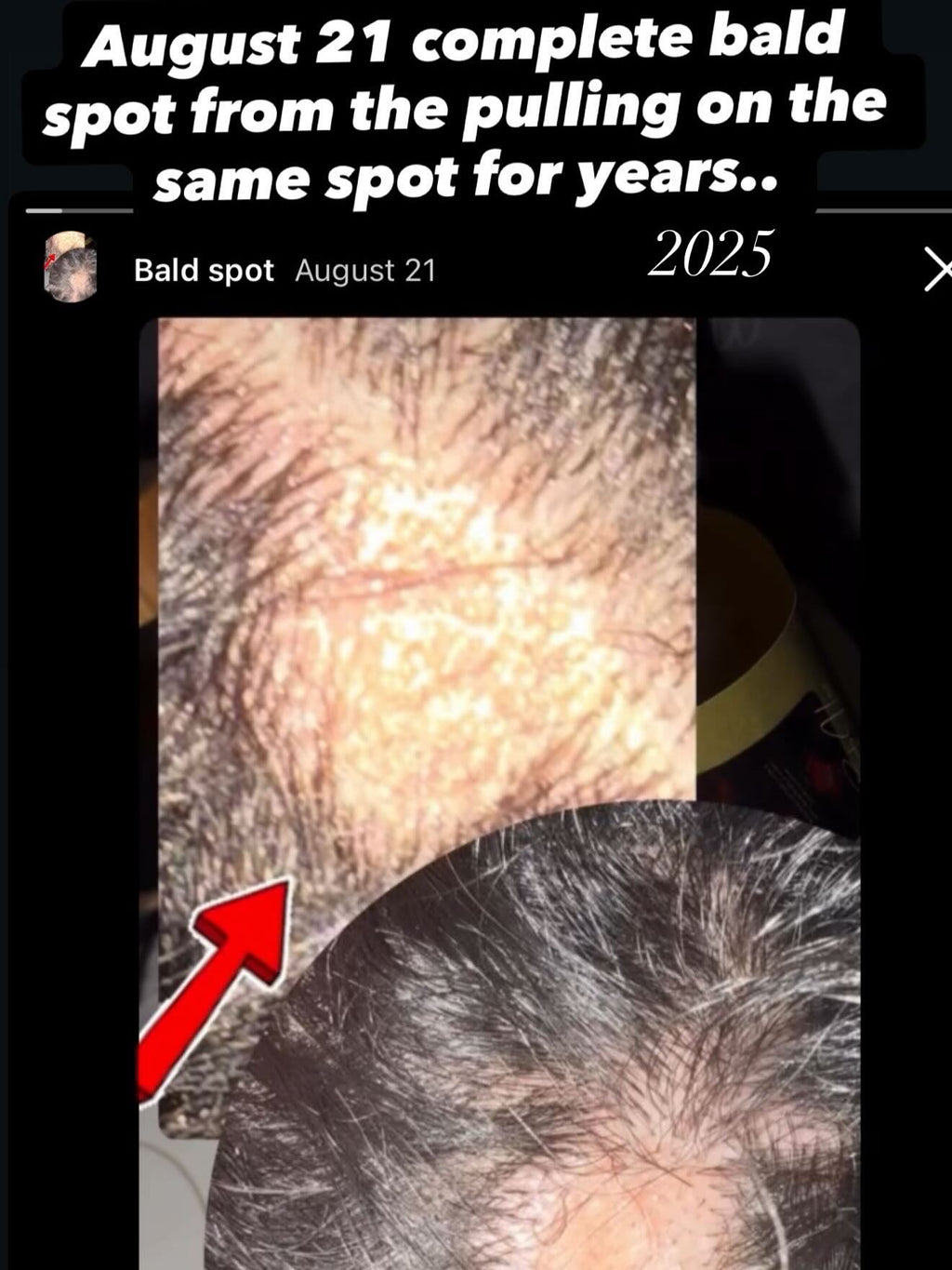 Double Your Hair Growth Oils 4oz (Tropic Botanical Scented)