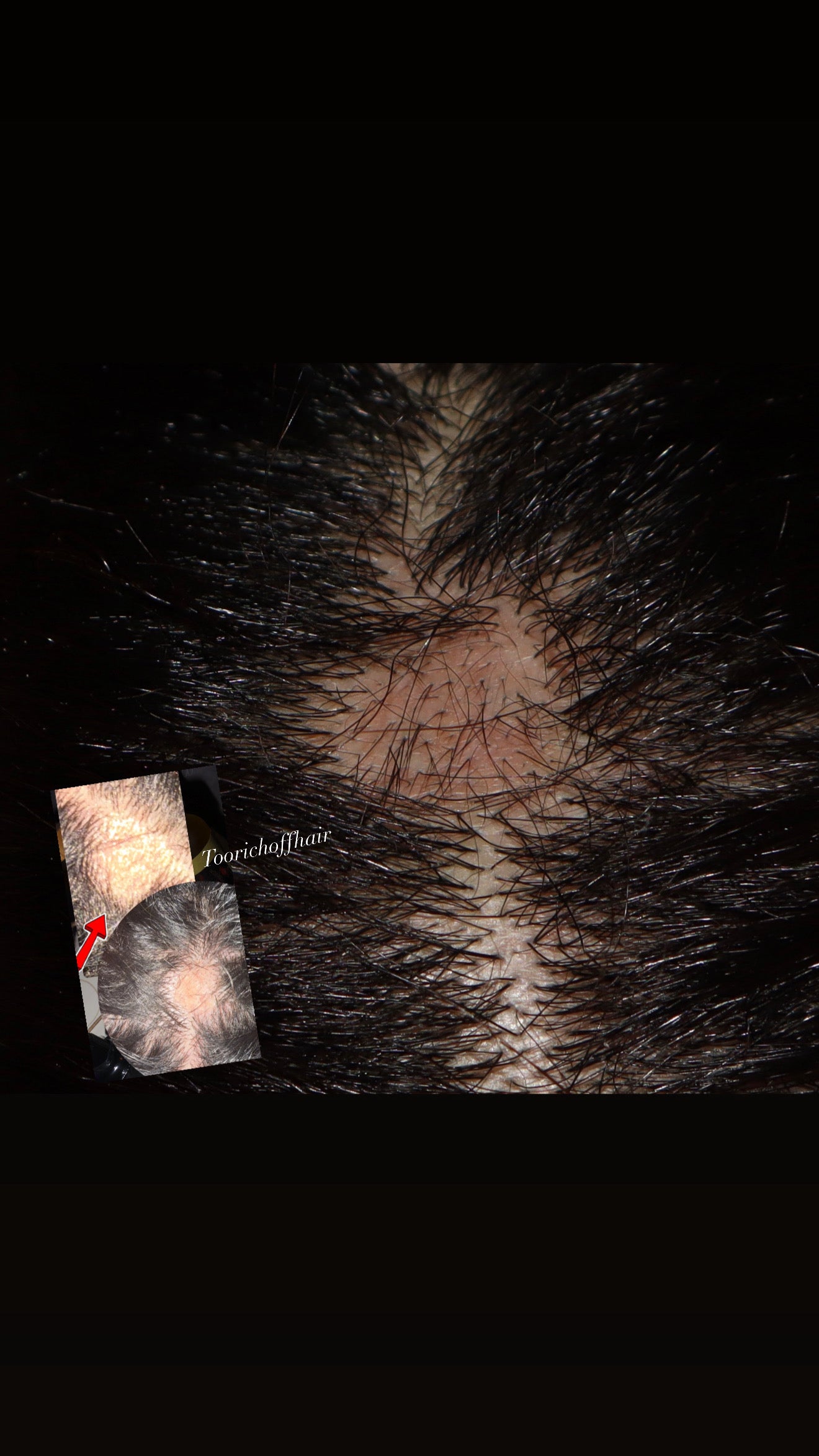 Extra Strength Growth Elixir — TheOil 4 oz (Tropic Botanical Scented)